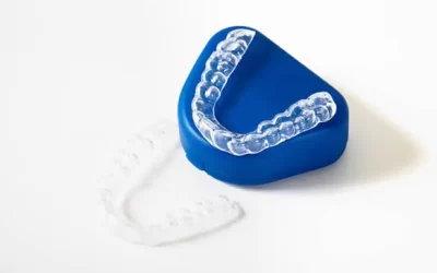Sports and Orthodontics in Northridge: Protecting Your Teeth and Jaw During Physical Activity